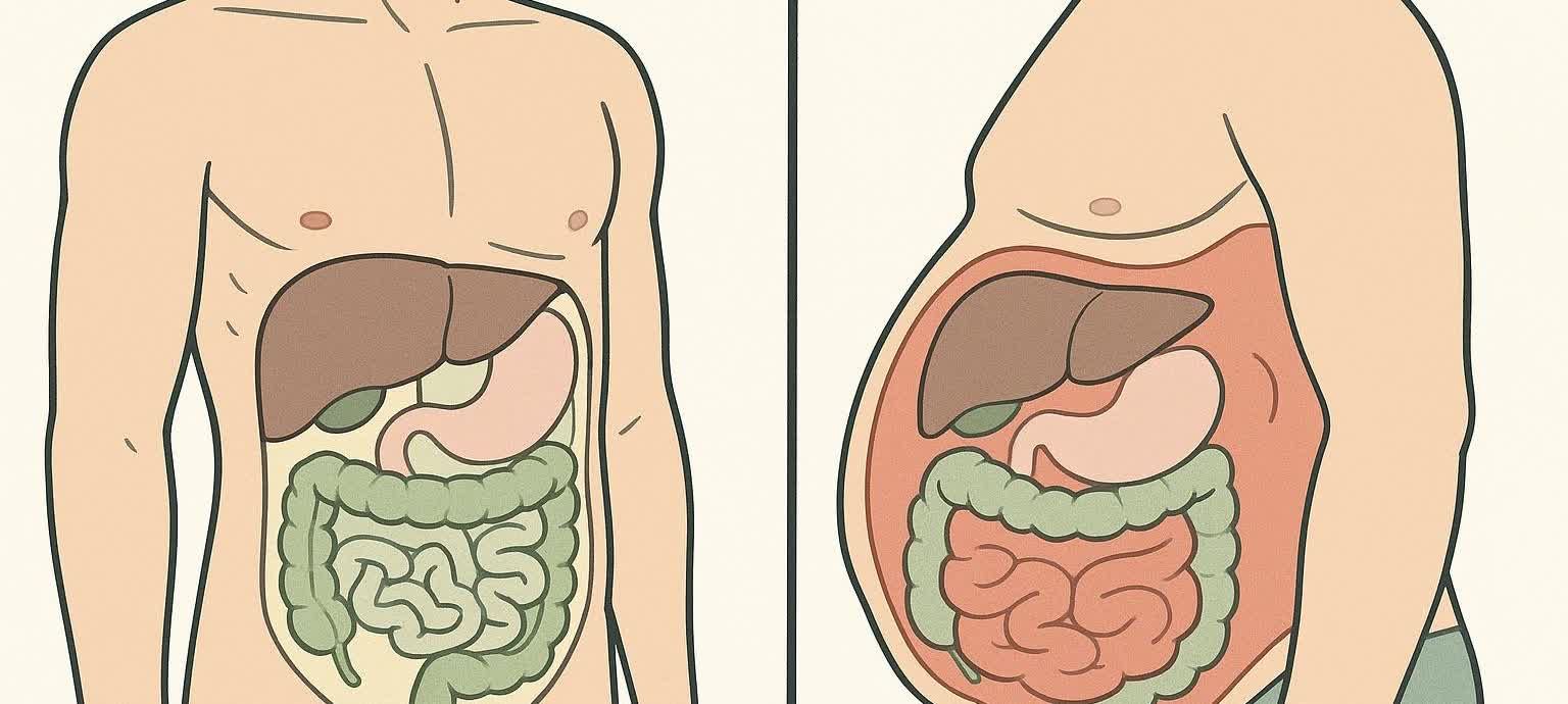 Illustration comparing a healthy male abdomen with one containing excess visceral fat, highlighting the danger of deep abdominal fat. The illustration shows a cross-section of a male torso, with the left side depicting a healthy abdomen and the right side showing an abdomen with a significant amount of orange-colored visceral fat surrounding the organs.
