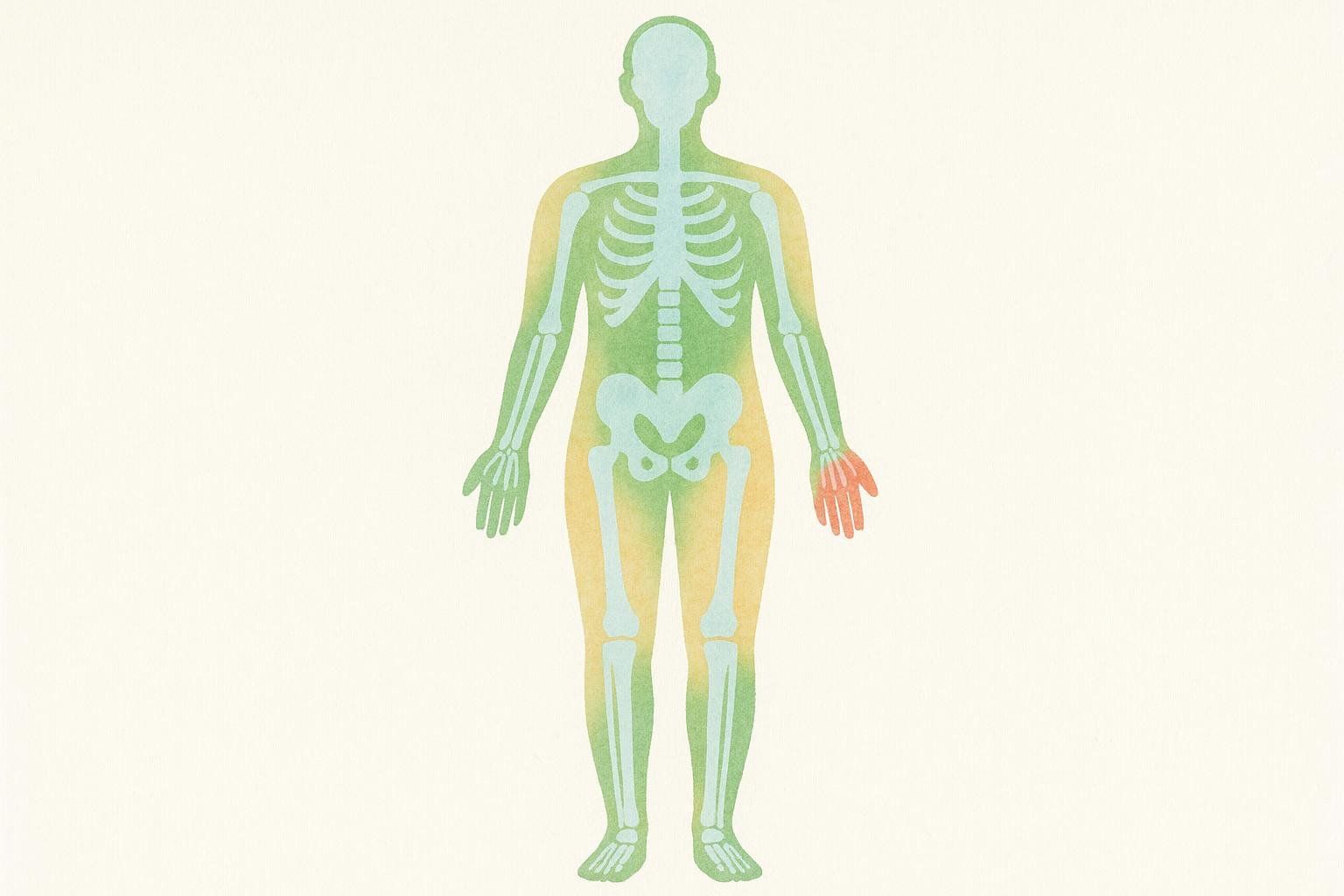 Abstract visualization of human body with fat shown in orange, lean mass in green, and bones in blue, with the left hand highlighted in red.