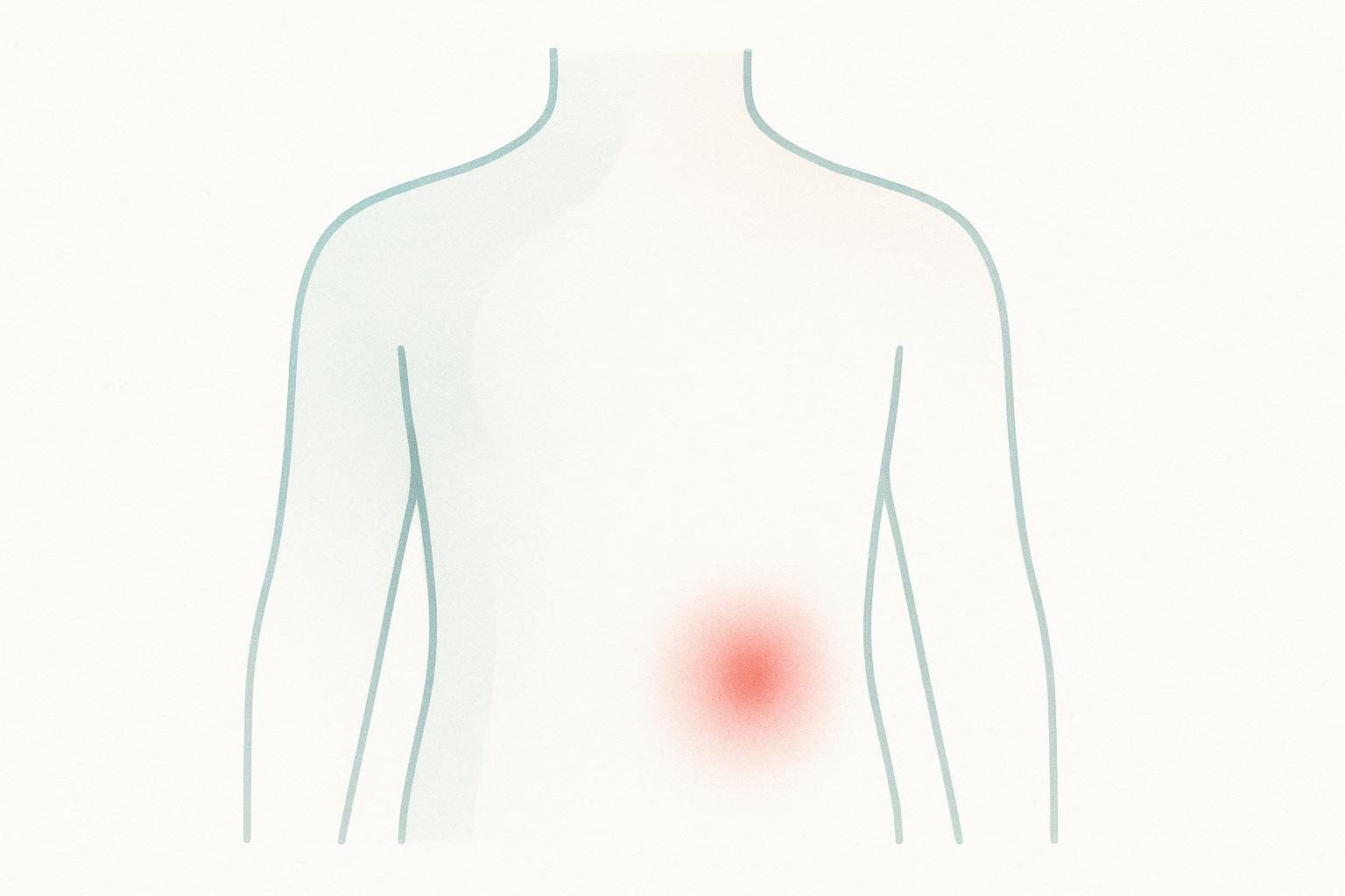 A simple illustration showing a red area on an abstract abdomen, representing a common mild side effect of Sermorelin: injection site reaction.