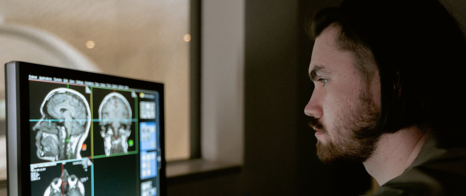 A man with a beard is looking at a computer screen displaying medical images of a brain scan.