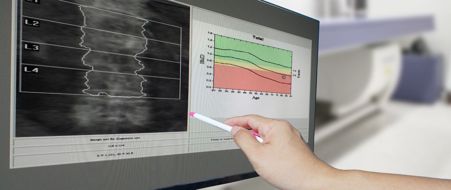 A report of a bone density test showing an image of the measured portion of the spine and a line graph of bone mineral density by age. A pointer highlights the bone mineral density graph.