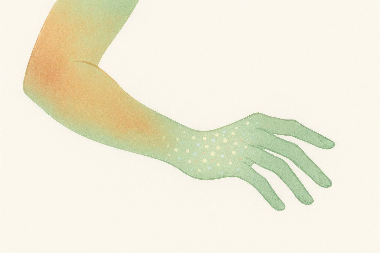 An illustration of a human arm with an elbow bent, transitioning from an orange hue at the bicep to green at the forearm and hand. The forearm and hand are covered with small, circular patterns in various colors, giving a shimmering or tingling effect. This represents the skin-tingling side effect known as paresthesia, associated with supplements like beta-alanine.