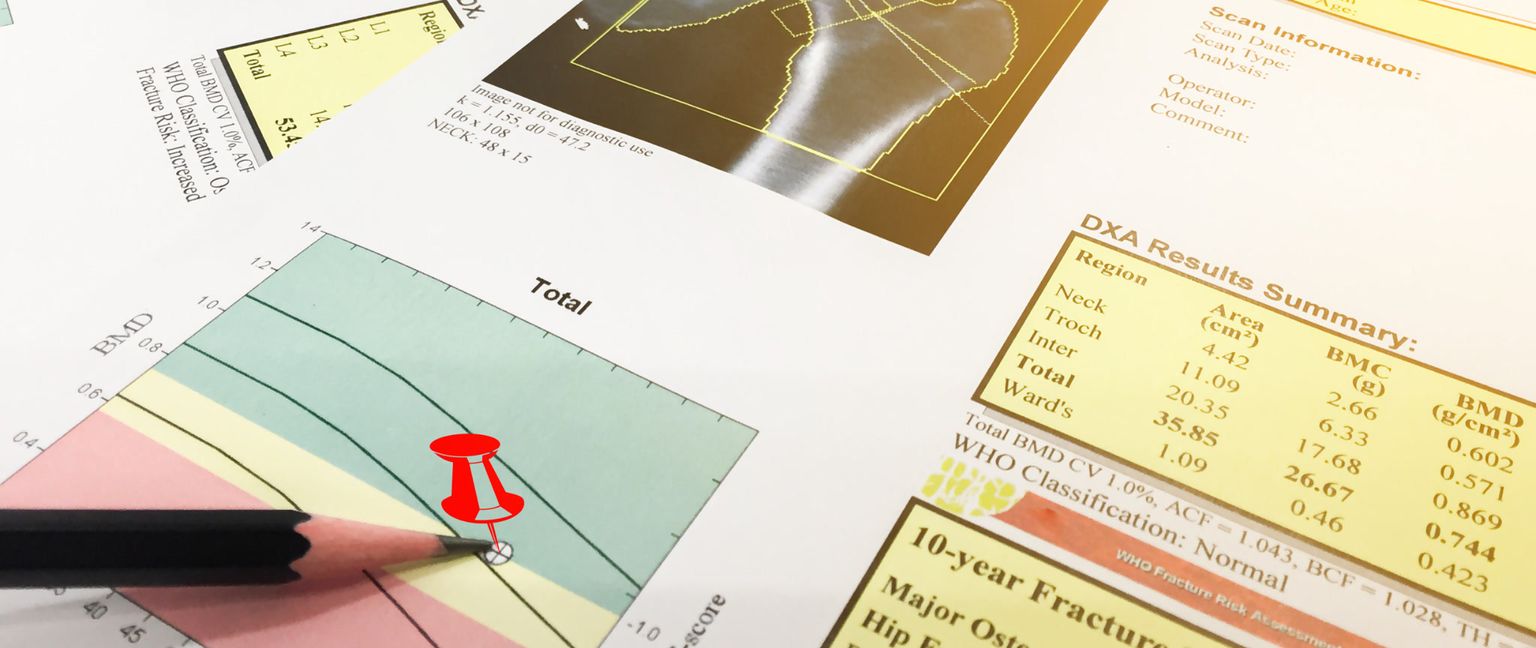 A close-up view of a DEXA scan report for bone density, showing a graph, an X-ray image of a bone, and a summary table of results, with a red pushpin indicating a data point on the graph.