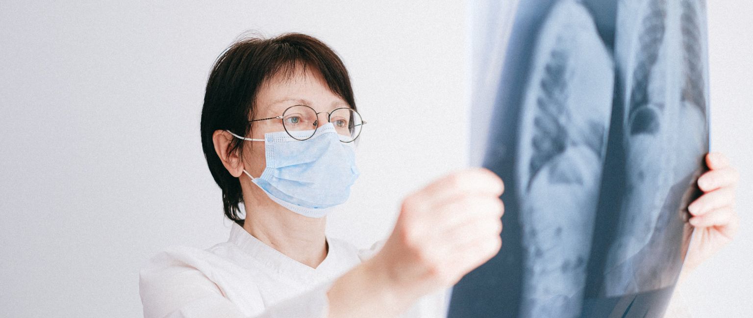A doctor in a face mask and glasses holds up a medical scan.