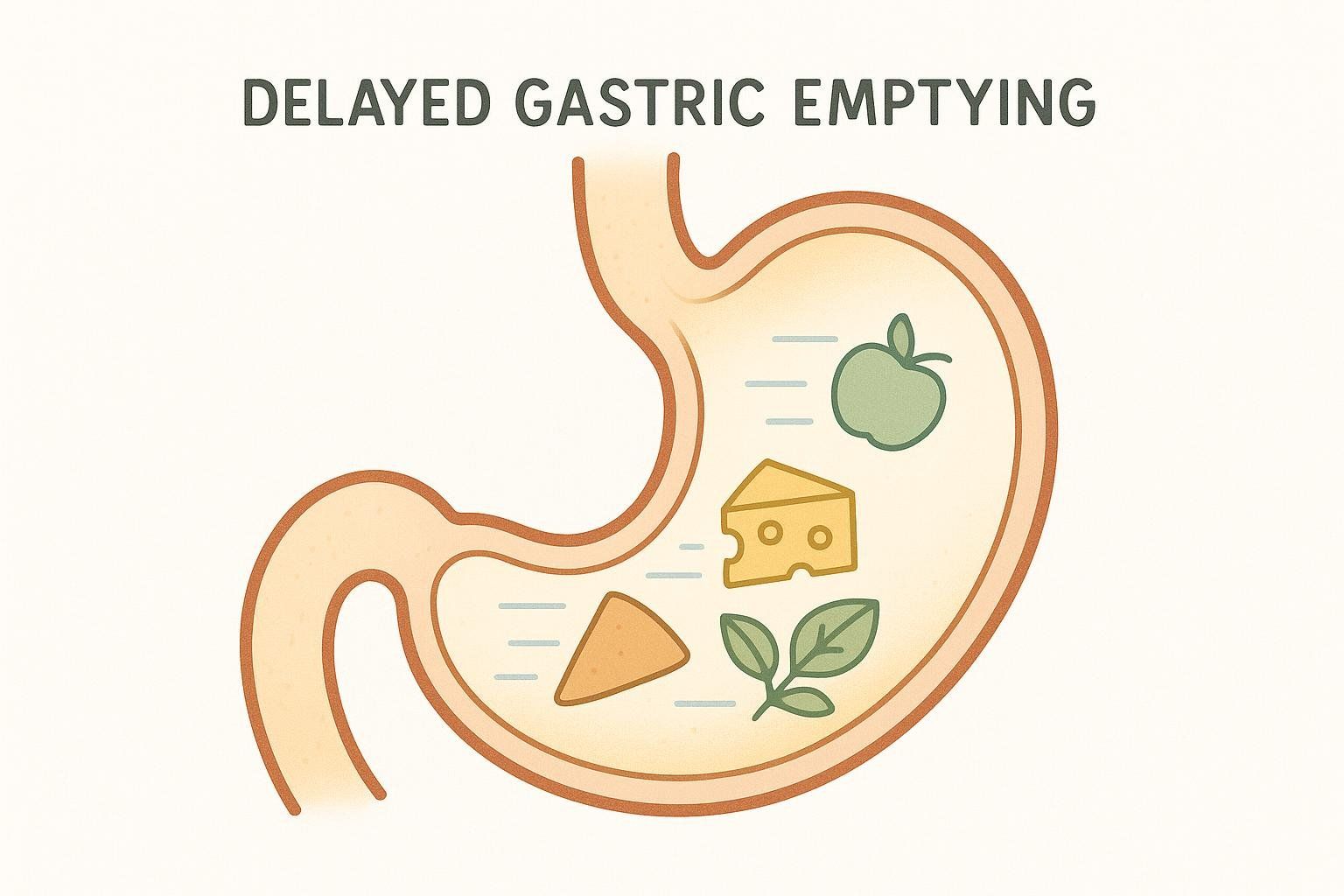 Stylized illustration of a stomach with an apple, cheese triangle, and leaf icons representing food. Horizontal lines indicate slowing and delay of food passage in the stomach.